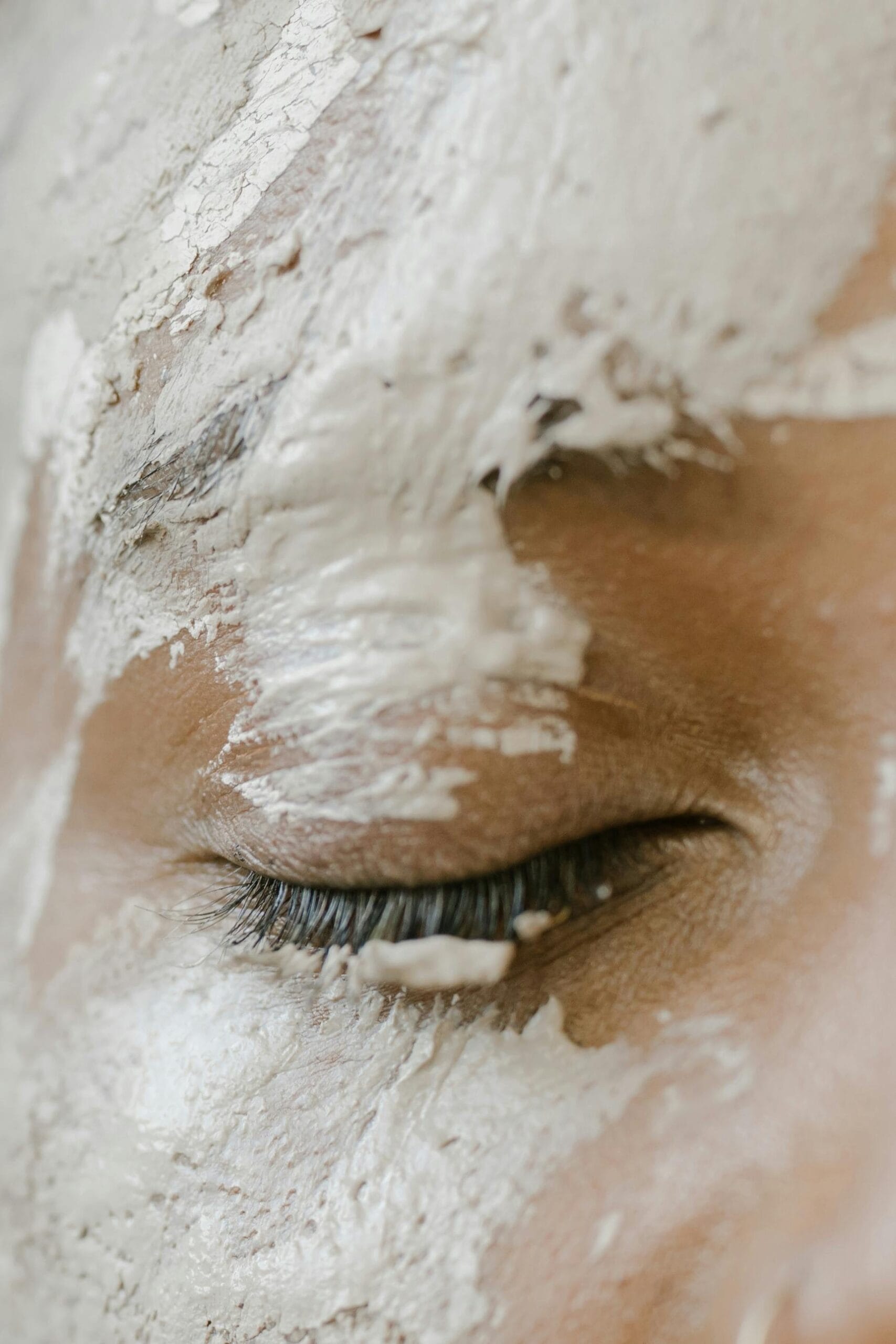 ultimate-get-rid-of-blackheads-teen