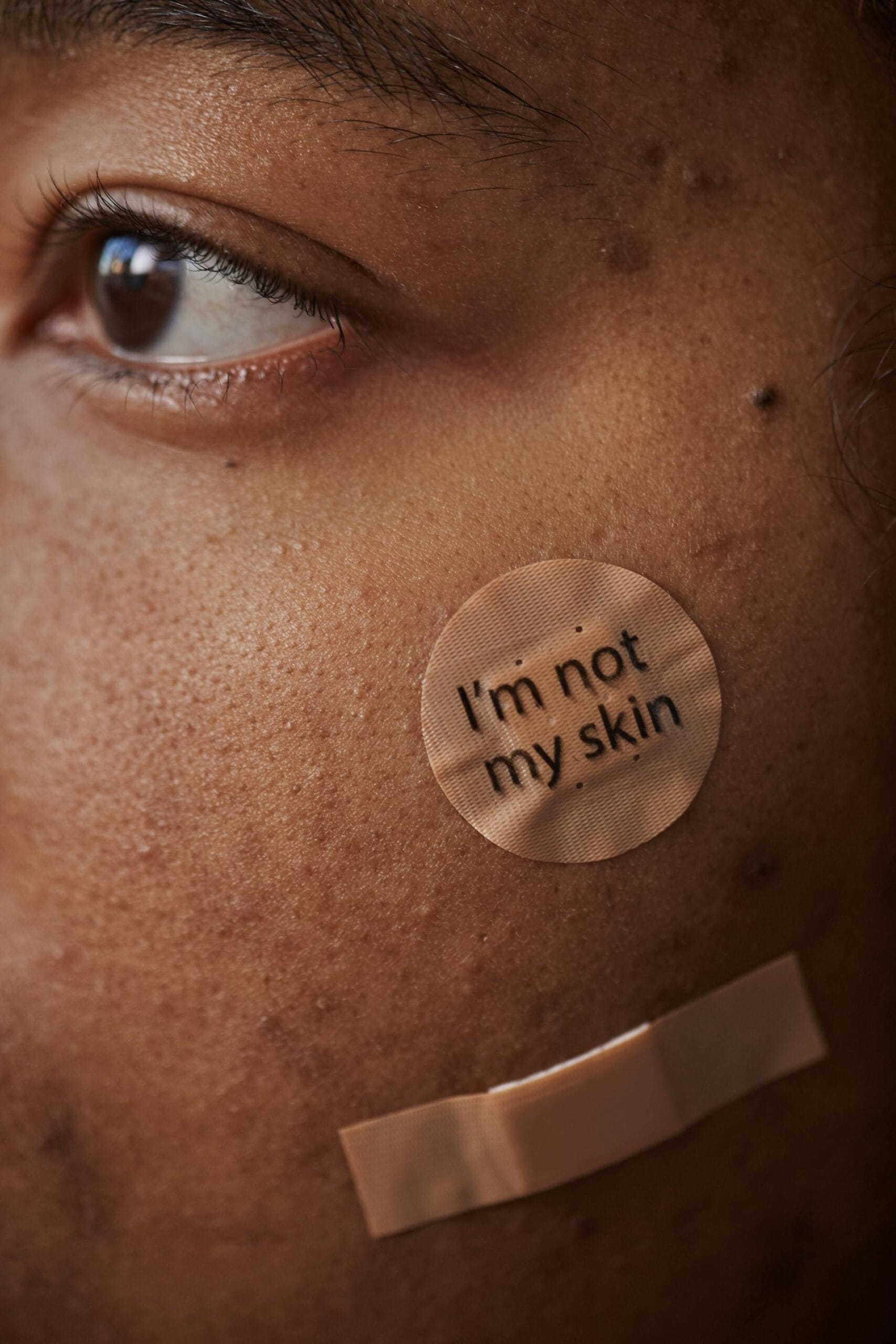 The Real Deal About Preventing Breakouts